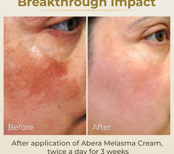 ABERA Belani Retinol Cream for Face, hidratante facial con crema de colágeno y ácido hialurónico, antiarrugas reduce las líneas finas, crema nocturna antienvejecimiento para mujeres