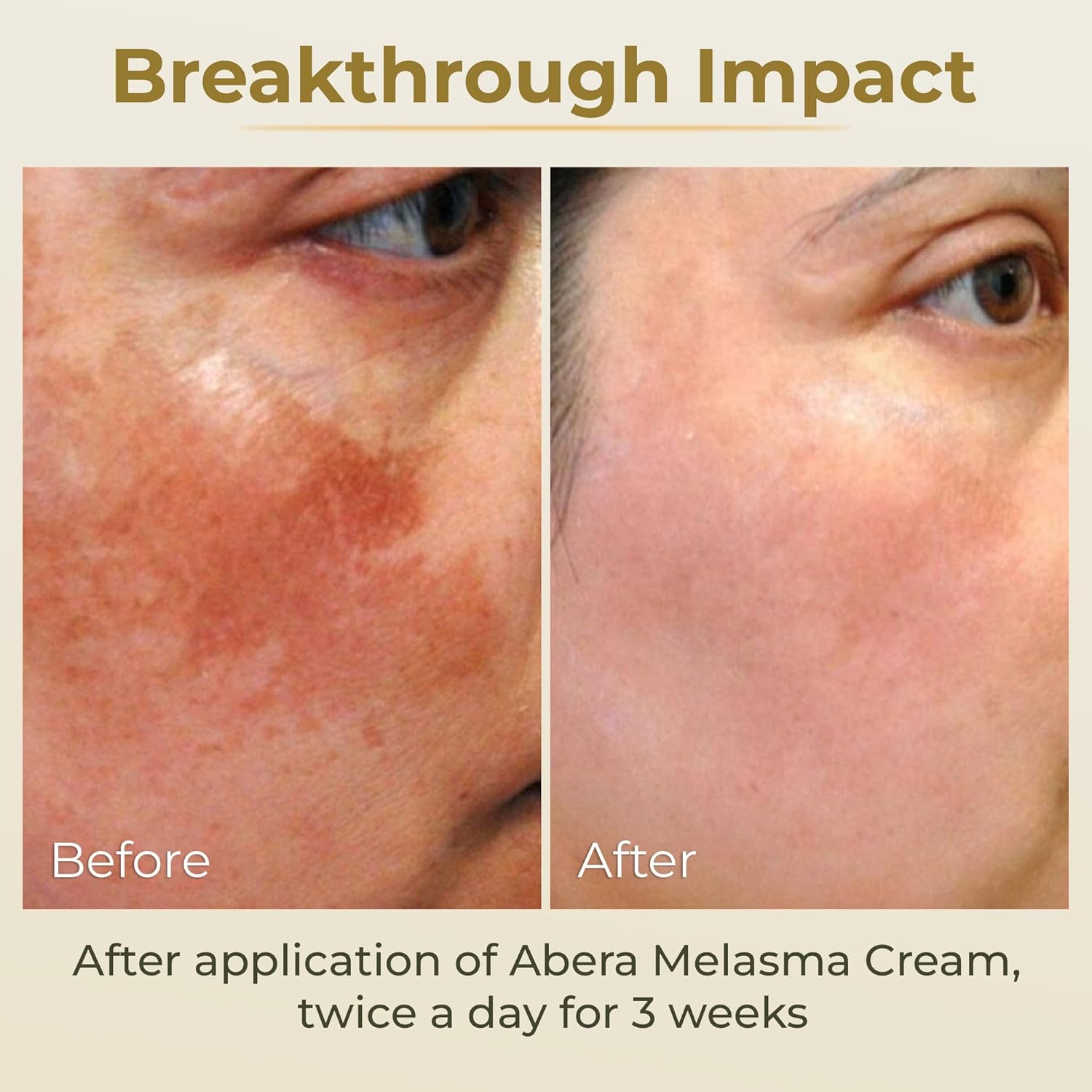 ABERA Belani Retinol Cream for Face, hidratante facial con crema de colágeno y ácido hialurónico, antiarrugas reduce las líneas finas, crema nocturna antienvejecimiento para mujeres