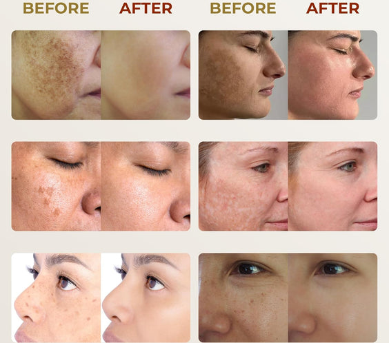 ABERA Belani Retinol Cream for Face, hidratante facial con crema de colágeno y ácido hialurónico, antiarrugas reduce las líneas finas, crema nocturna antienvejecimiento para mujeres